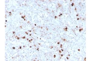 Formalin-fixed, paraffin-embedded human spleen stained with IgM Recombinant Rabbit Monoclonal Antibody (IGHM/3776R). (Recombinant IGHM 抗体)
