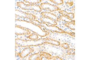 Immunohistochemistry analysis of paraffin-embedded rat kidney using,Cadherin 16 (ABIN7073265) at dilution of 1: 2000 (Cadherin-16 抗体)