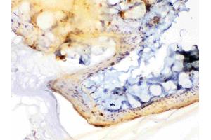 Immunohistochemistry (IHC) image for anti-Periplakin (PPL) (AA 1664-1701), (C-Term) antibody (ABIN5518787)