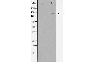 Western blot analysis on NIH-3T3 cell lysate using HDAC5 Antibody,The lane on the left is treated with the antigen-specific peptide. (HDAC5 抗体  (C-Term))