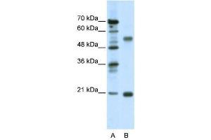 Western Blot showing CHRNB3 antibody used at a concentration of 1-2 ug/ml to detect its target protein. (CHRNB3 抗体  (Middle Region))