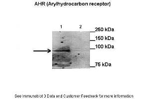 Lanes:   Lane1: 50 ug HepG2 nuclei extract + benzo[a]pyrene Lane2: 50 ug HepG2 cytoplasm extract + benzo[a]pyrene  Primary Antibody Dilution:   1:1000  Secondary Antibody:   Anti-rabbit HRP  Secondary Antibody Dilution:   1:1000  Gene Name:   AHR (Arylhydrocarbon receptor)  Submitted by:   Anonymous (Aryl Hydrocarbon Receptor 抗体  (N-Term))