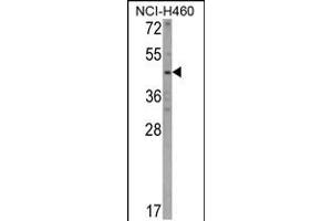 Western blot analysis of KYNU Antibody in NCI-H460 cell line lysates (35ug/lane) (KYNU 抗体  (C-Term))