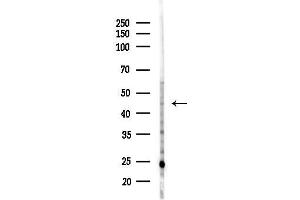 anti-Hydroxysteroid Dehydrogenase Like 2 (HSDL2) (C-Term) antibody