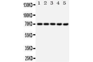 Western Blotting (WB) image for anti-Heat Shock 70kDa Protein 1A (HSPA1A) (AA 577-596), (C-Term) antibody (ABIN3044190) (HSP70 1A 抗体  (C-Term))