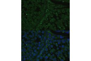 Immunofluorescence analysis of rat testis cells using IGF2BP2/IMP2 antibody (ABIN6131799, ABIN6142242, ABIN6142244 and ABIN6218878) at dilution of 1:100. (IGF2BP2 抗体  (AA 330-599))