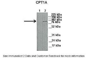 Lanes:   1. (CPT1A 抗体  (Middle Region))