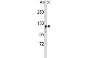 Western Blotting (WB) image for anti-serine/threonine Kinase 31 (STK31) antibody (ABIN3003073) (STK31 抗体)
