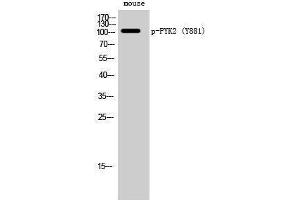 Western Blotting (WB) image for anti-PTK2B Protein tyrosine Kinase 2 beta (PTK2B) (pTyr881) antibody (ABIN3179627) (PTK2B 抗体  (pTyr881))