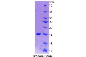 SDS-PAGE analysis of Rat PAX6 Protein. (PAX6 蛋白)