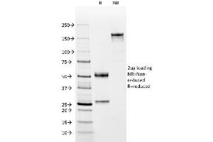 SDS-PAGE Analysis Purified Complement 4d Mouse Monoclonal Antibody (C4D204). (C4A 抗体)