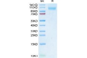 DPP4 Protein (AA 29-766) (His tag)