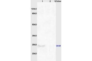 SDS-PAGE (SDS) image for anti-ChaC, Cation Transport Regulator Homolog 1 (CHAC1) (AA 131-222) antibody (ABIN872557)