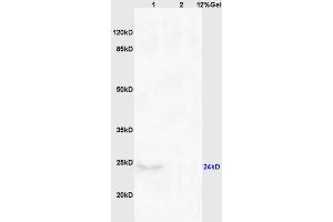 Lane 1: mouse brain lysates Lane 2: mouse kidney lysates probed with Anti CHAC1 Polyclonal Antibody, Unconjugated (ABIN872557) at 1:200 in 4 °C. (CHAC1 抗体  (AA 131-222))
