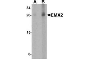 Western blot analysis of EMX2 in human lung tissue lysate with EMX2 Antibody at (A) 1 and (B) 2 µg/ml.