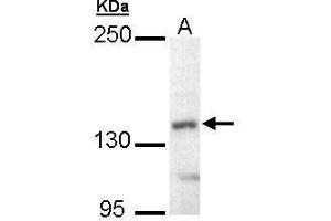 WB Image Sample (30 ug of whole cell lysate) A: Hep G2 , 5% SDS PAGE antibody diluted at 1:10000 (UBE4B 抗体  (C-Term))