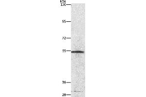 Western blot analysis of Lovo cell, using NEK2 Polyclonal Antibody at dilution of 1:727 (NEK2 抗体)
