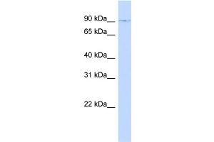 WB Suggested Anti-ZNF226 Antibody Titration:  0. (ZNF226 抗体  (N-Term))