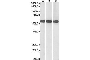 ABIN2562850 (0. (GLUD1 抗体  (Internal Region))