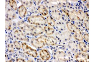 Anti- CRY2 Picoband antibody,IHC(P) IHC(P): Mouse Kidney Tissue (CRY2 抗体  (N-Term))