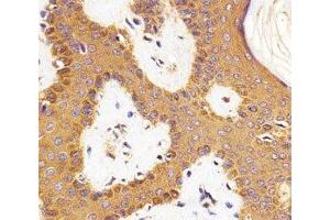 Immunohistochemistry (IHC) image for anti-RAC1 antibody (ABIN3032428)