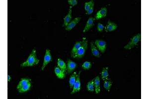 Immunofluorescent analysis of HepG2 cells using ABIN7150873 at dilution of 1:100 and Alexa Fluor 488-congugated AffiniPure Goat Anti-Rabbit IgG(H+L) (Dnah5 抗体  (AA 2364-2560))