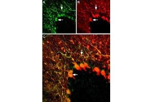 Immunohistochemistry (IHC) image for anti-Potassium Voltage-Gated Channel, Shaker-Related Subfamily, Member 5 (KCNA5) (AA 268-279), (Extracellular) antibody (ABIN7043529)