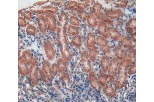 Used in DAB staining on fromalin fixed paraffin- embedded kidney tissue (Talin 抗体  (AA 975-1181))