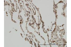 Image no. 1 for anti-NF-kappa-B inhibitor beta (NFKBIB) (AA 56-145) antibody (ABIN598839) (NFKBIB 抗体  (AA 56-145))