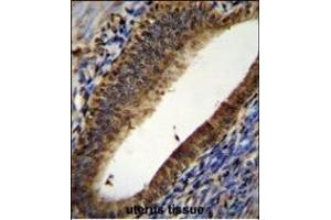 PT Antibody (N-term) (ABIN655715 and ABIN2845165) immunohistochemistry analysis in forlin fixed and paraffin embedded hun uterus tissue followed by peroxidase conjugation of the secondary antibody and DAB staining. (PTMA 抗体  (N-Term))