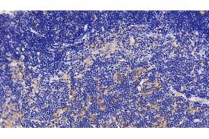 Immunohistochemistry (IHC) image for anti-Interleukin 1 Receptor Accessory Protein (IL1RAP) (AA 420-558) antibody (ABIN7438568)