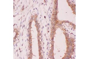 Immunohistochemistry (IHC) image for anti-Nuclear Factor of kappa Light Polypeptide Gene Enhancer in B-Cells 2 (NFKB2) (AA 1-340) antibody (ABIN3043293)