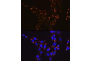 Immunofluorescence analysis of NIH-3T3 cells using GLUD1 Rabbit mAb (ABIN7267411) at dilution of 1:100 (40x lens). (GLUD1 抗体)