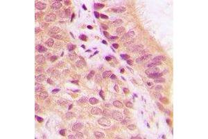Immunohistochemistry (IHC) image for anti-Isocitrate Dehydrogenase 1 (NADP+), Soluble (IDH1) antibody (ABIN7307898)