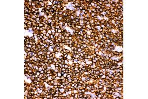 Anti-CD20 Picoband antibody,  IHC(P): Human Tonsil Tissue (CD20 抗体  (AA 1-261))