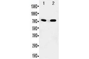 Anti-SDHA antibody, Western blotting Lane 1: Rat Heart Tissue Lysate Lane 2: COLO320 Cell Lysate