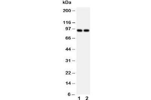 Western blot testing of MCM3 antibody and Lane 1:  HeLa;  2: Jurkat cell lysate. (MCM3 抗体  (N-Term))