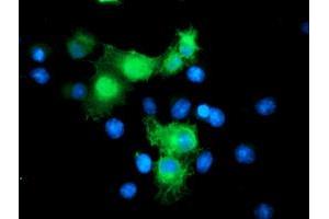 Anti-SMS mouse monoclonal antibody (ABIN2454723) immunofluorescent staining of COS7 cells transiently transfected by pCMV6-ENTRY SMS (RC200619). (SMS 抗体)