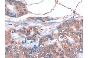 Immunohistochemistry (IHC) image for anti-Interleukin 33 (IL33) (AA 112-270) antibody (ABIN7426418)