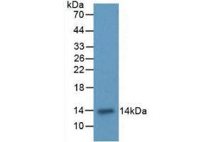 Western blot analysis of recombinant Rat ITGaM. (CD11b 抗体  (AA 598-700))
