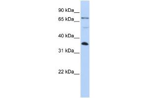 WB Suggested Anti-LASP1 Antibody Titration: 0. (LASP1 抗体  (C-Term))