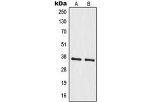 Western blot analysis of MRPS35 expression in A549 (A), HeLa (B) whole cell lysates. (MRPS35 抗体  (Center))