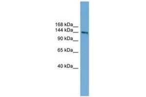 Image no. 1 for anti-Deleted in Colorectal Carcinoma (DCC) (AA 1079-1128) antibody (ABIN6744827)