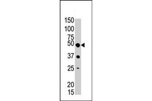 The PIGK polyclonal antibody  is used in Western blot to detect PIGK in mouse liver tissue lysate . (PIGK 抗体  (C-Term))