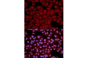 Immunofluorescence analysis of U2OS cells using PPP1CB antibody.