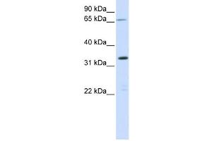 Western Blotting (WB) image for anti-Chromosome 19 Open Reading Frame 47 (C19orf47) antibody (ABIN2459199) (C19orf47 抗体)