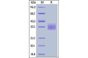 SDS-PAGE (SDS) image for Sialic Acid Binding Ig-Like Lectin 15 (SIGLEC15) (AA 20-263) protein (His tag) (ABIN6809873)