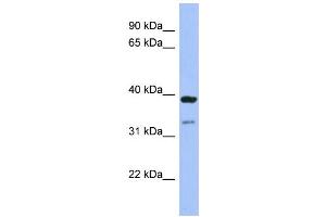 WB Suggested Anti-RASSF7 Antibody Titration:  0.