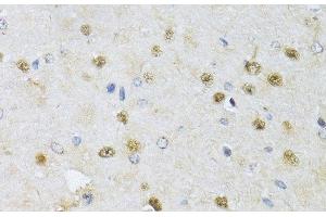 Immunohistochemistry of paraffin-embedded Rat brain using CMAS Polyclonal Antibody at dilution of 1:150 (40x lens). (CMAS 抗体)