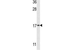 Western blot analysis of LC3II antibody and MCF-7 lysate (LC3B 抗体  (AA 74-106))